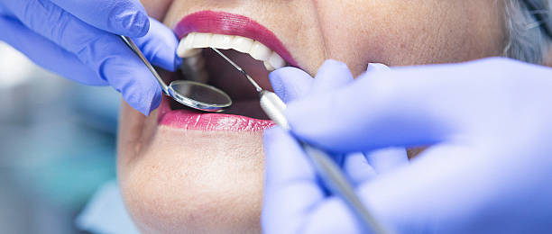 Best Emergency Dental Care for Broken or Chipped Teeth in Red Bank, TN